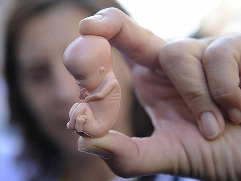 Qafqazda ən çox abort hansı ölkədə qeydə alınır? - STATİSTİKA