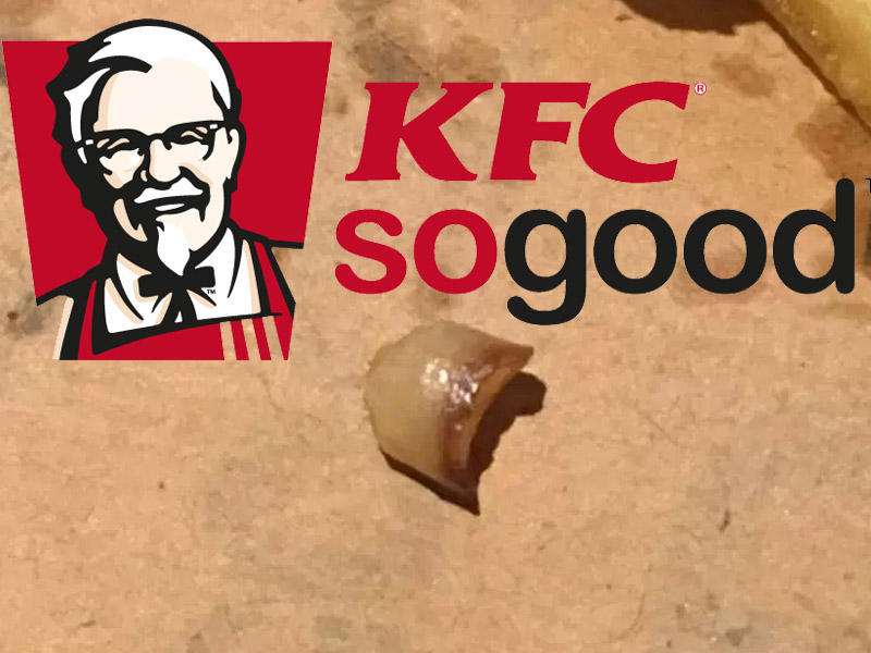 "KFC"də çipsin içindən elə şey çıxdı ki... - FOTO