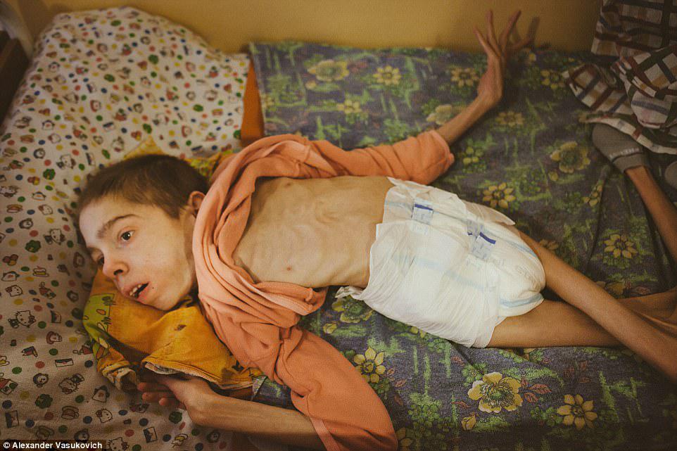 Uşaqların böyüməyib qocaldıqları, ölüm düşərgəsi təki internatdan REPORTAJ - VİDEO - FOTO