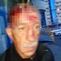 Bakıda vəhşilik: Yaşlı kişini armaturla döydülər - FOTO