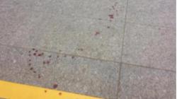 Dəmiryol stansiyasında silahlı hücum: yaralananlar var - Münhendə - VİDEO - FOTO
