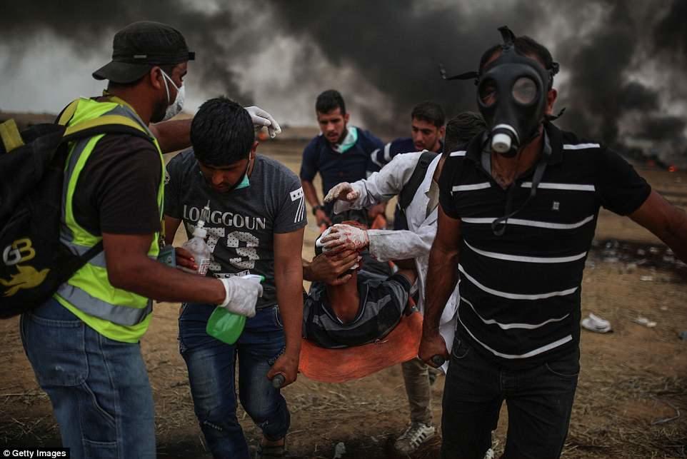 İsrail fələstinliləri gülləbaran edir: 43 ölü, minlərlə yaralı – Foto