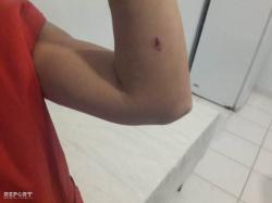 Sumqayıtda süpürgəçini qonşu qadın bıçaqladı - FOTO