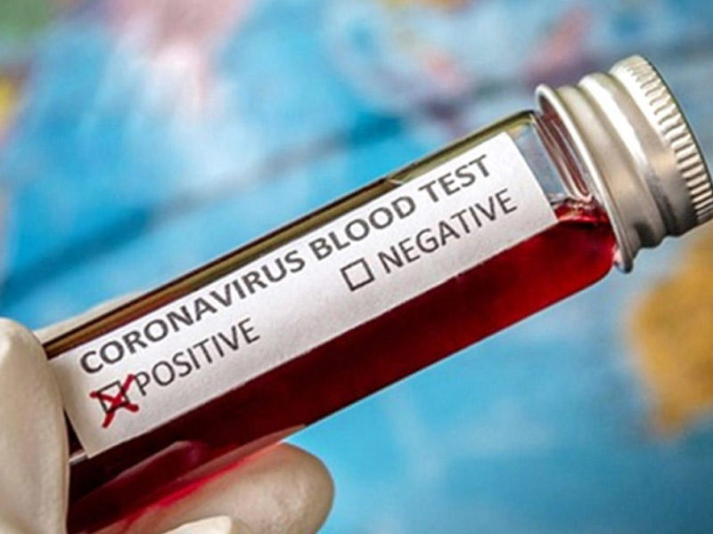 İranda ötən sutka koronavirus daşıyıcılarının sayı 3 mindən çox artıb