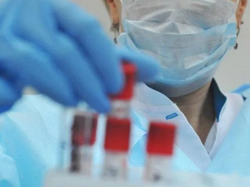 Azərbaycanda 104 koronavirusa yoluxma faktı qeydə alındı, 1 nəfər öldü, 38 nəfər sağaldı - Operativ Qərargah
