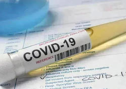 Gürcüstanda son sutkada koronavirusa 58 nəfər yoluxub, ölən olmayıb