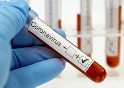 Toya gedən koronavirus xəstələri saxlanıldı