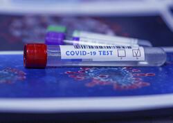 &quot;COVID-19-a qarşı vurulan vaksin digər viruslara qarşı yaranmış immunitetə təsir etmir&quot;